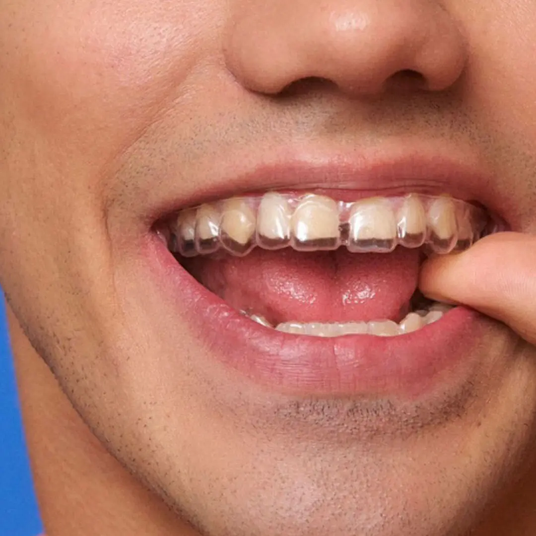 carrossel-karen-novo